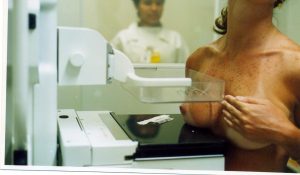 mamografia-exame-que-salva