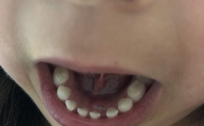 dentinho